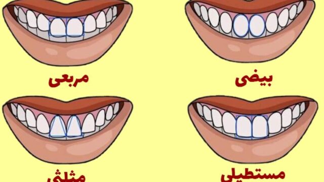 تست شخصیت شناسی با شکل دندان – جالب و واقعی