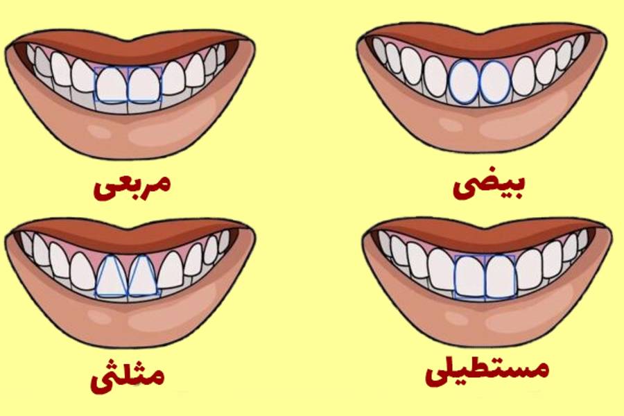 شخصیت شناسی از روی دندان نیش مدل دندان خرگوشی فاصله بین دو دندان جلو نشانه چیست دندان نیش بلند نشانه چیست دندان نیش تیز نشانه چیست فال دندان شخصیت شناسی از روی چهره دندان در فال قهوه