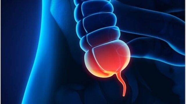 علائم التهاب آپاندیس در کودکان چگونه است؟ | عوارض ترکیدن آپاندیس در بدن