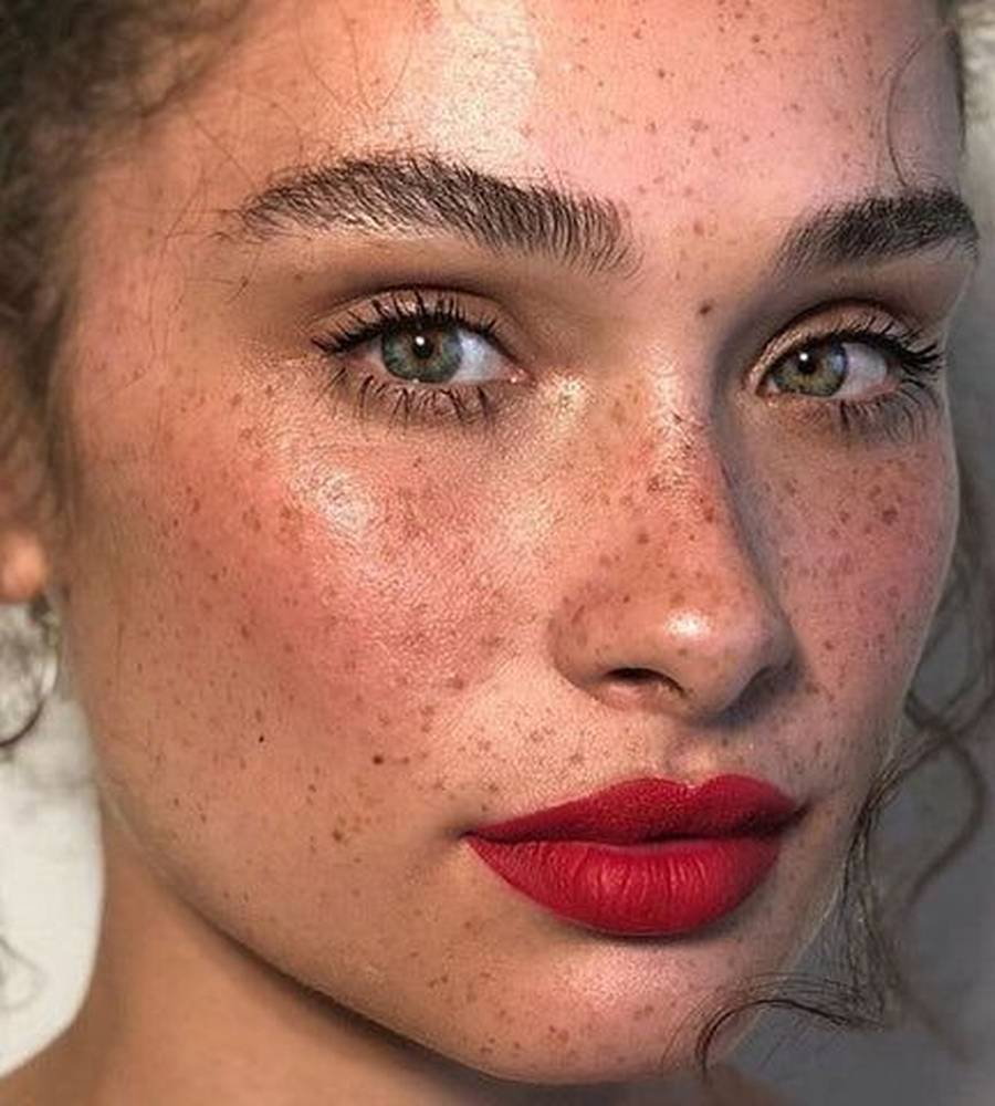 از بین بردن کک و مک صورت