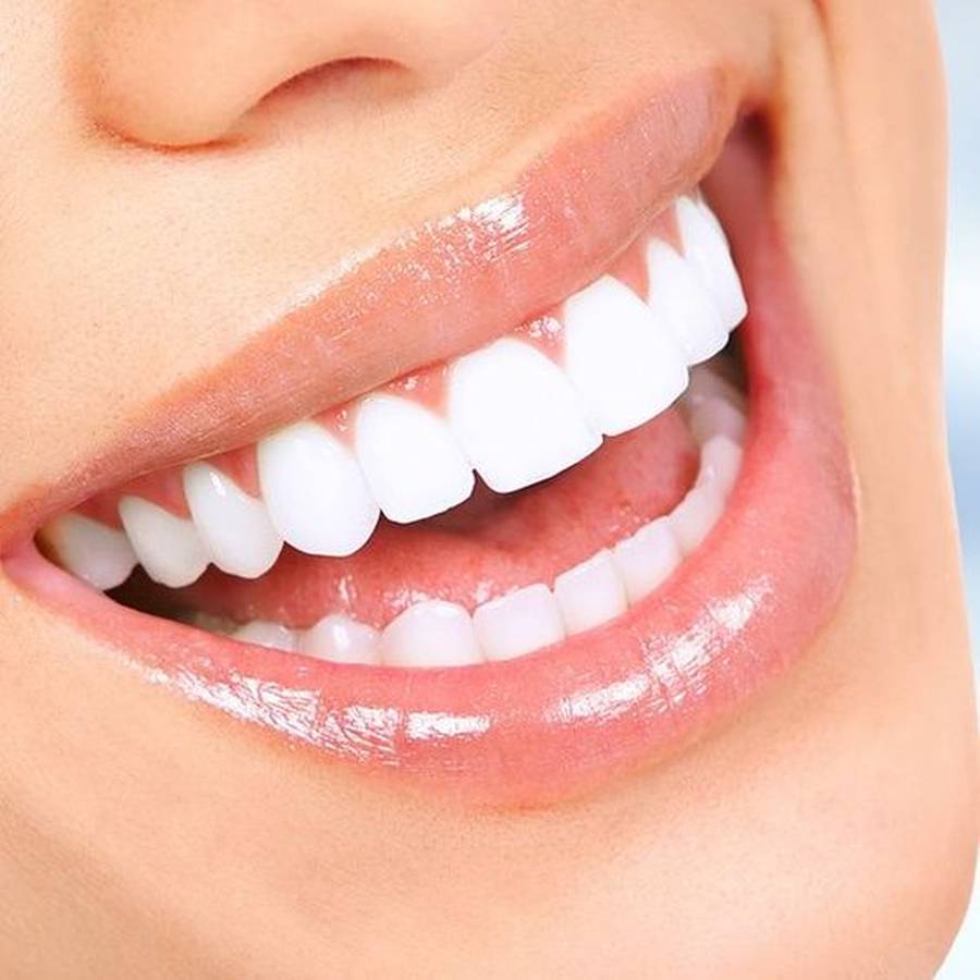 لمینت دندان یا کامپوزیت