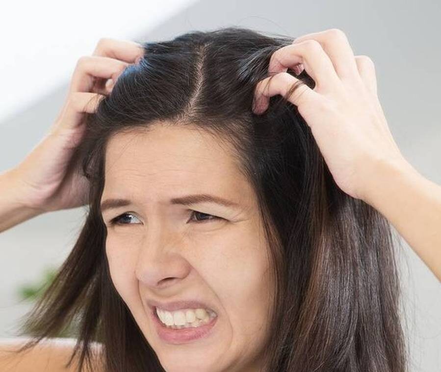 علت خارش سر بعد از شستشو