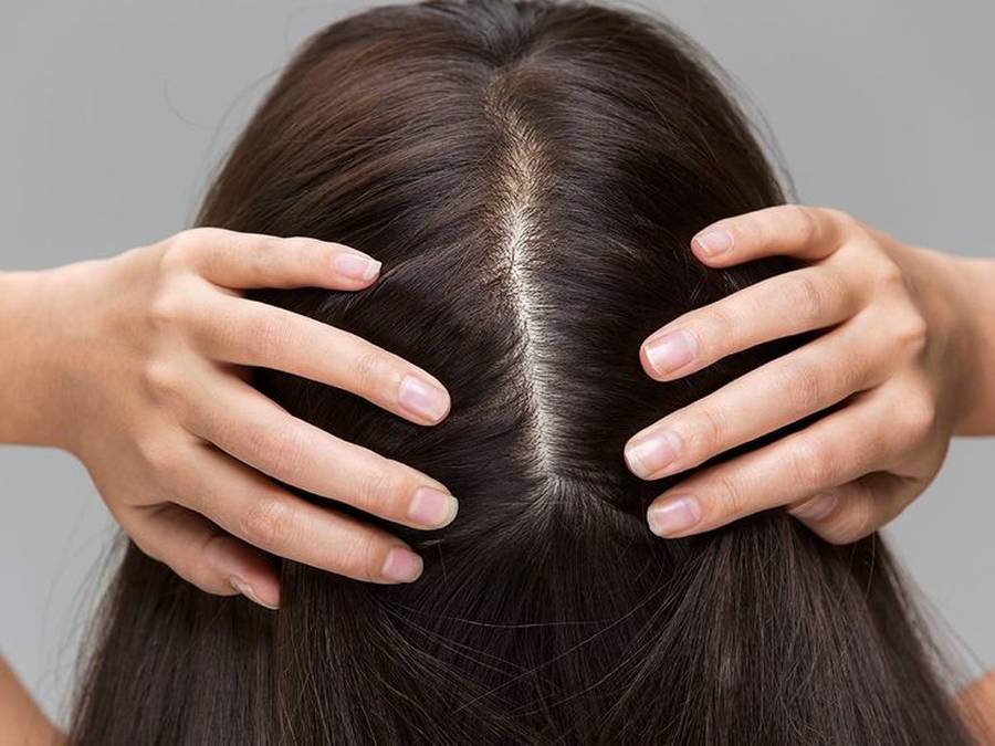 ماسک مو برای موخوره دیجی کالا
